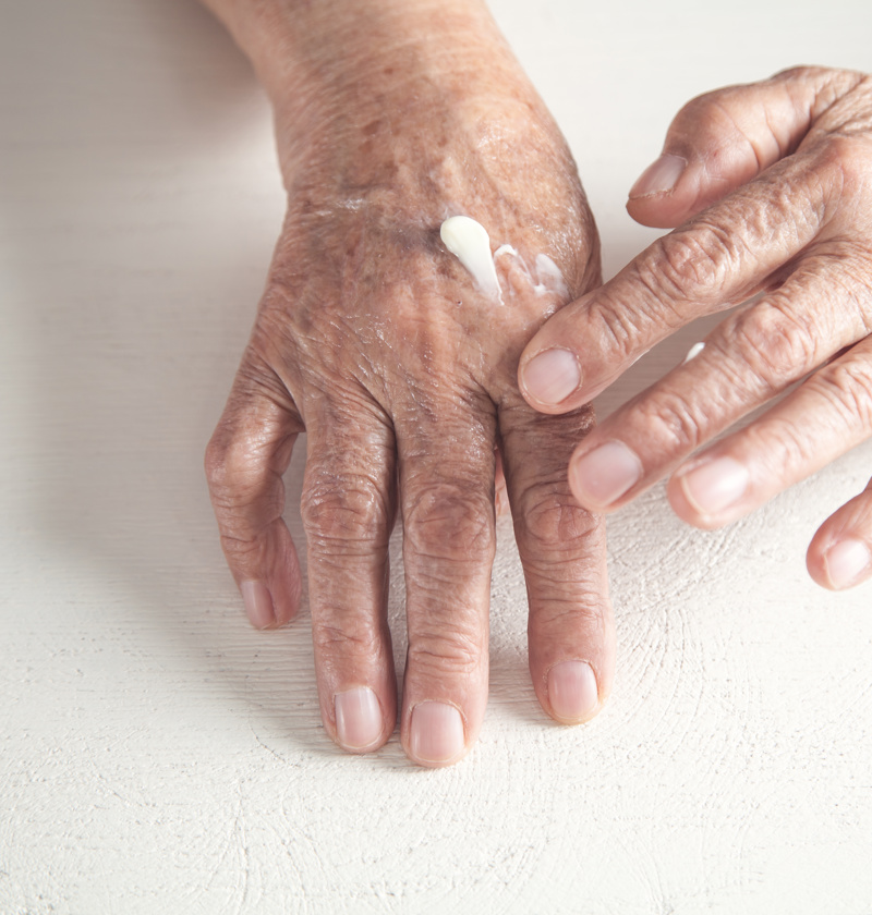 Barrier Creams for Elderly Parents - dignified image of cream being patch tested on hand