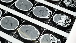 Brain scans